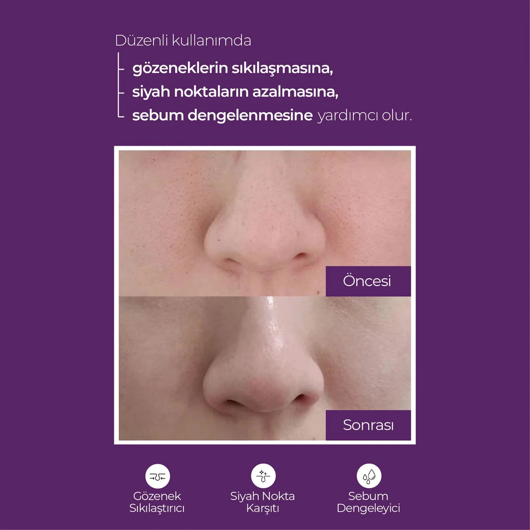 Superyou - Peeling Etkili Kapsül Tonik - Gözenek Sıkılaştırma, Ölü Hücrelerden Arınma, Leke Karşıtı